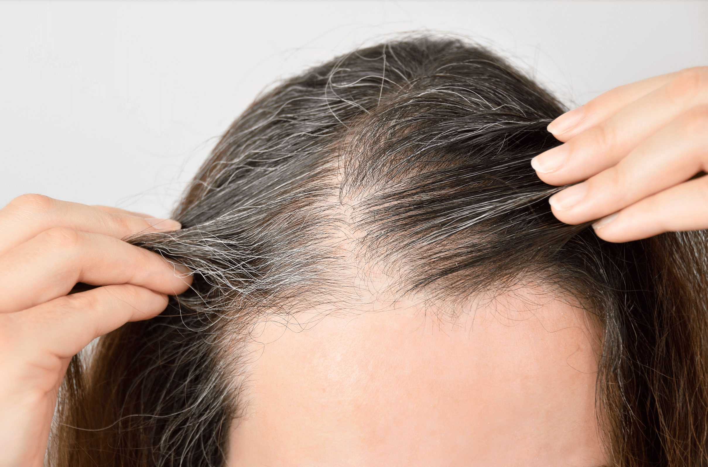 When Does Hair Grow Back After a Hair Transplant?
