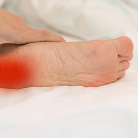 Plantar Fasciitis