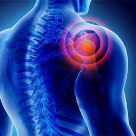 AC Joint Pain
