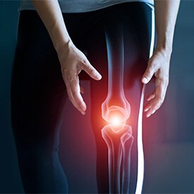 Knee Osteoarthritis